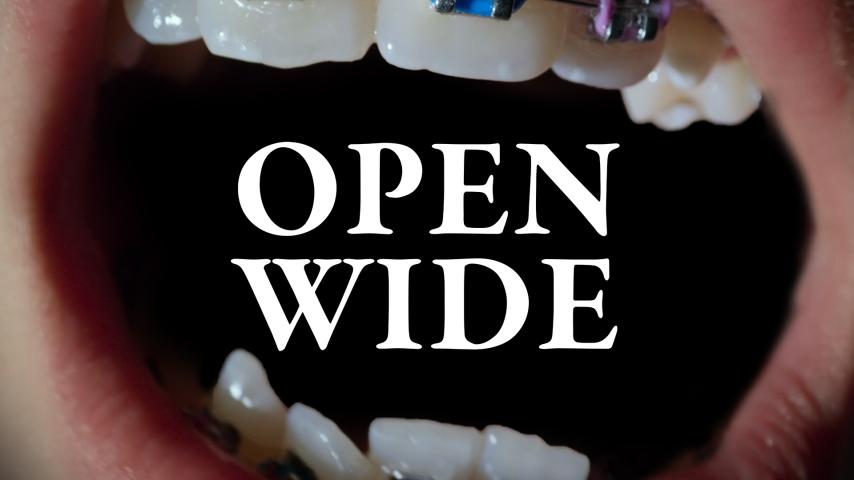 Open Wide (2024)